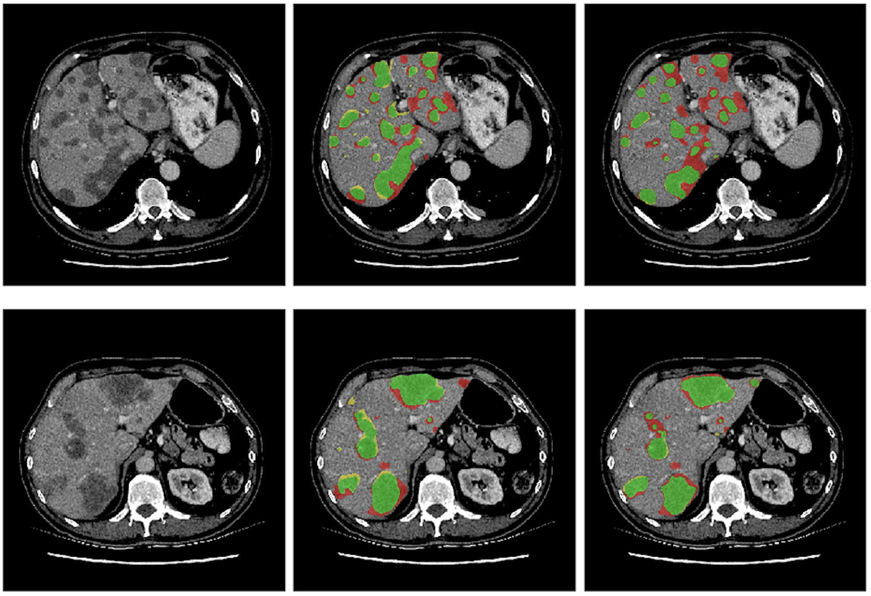 Simultaneous biomarker regression and localization